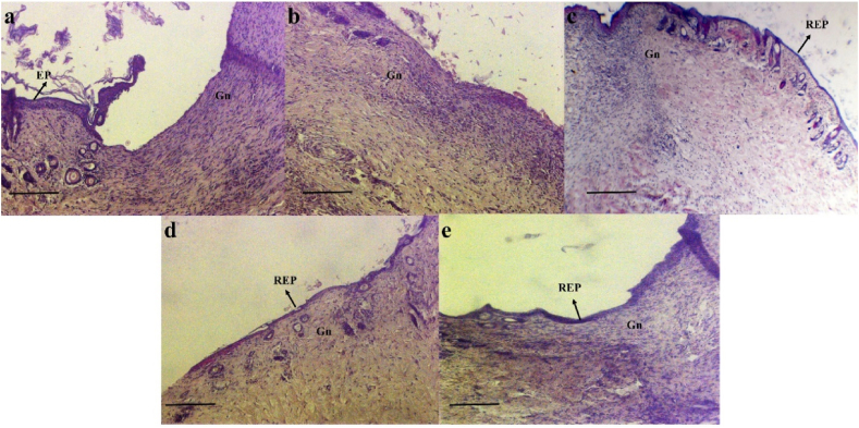 Fig. 16
