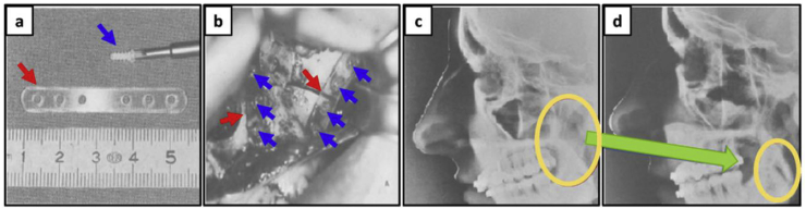 Fig. 6