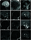 FIG 2.