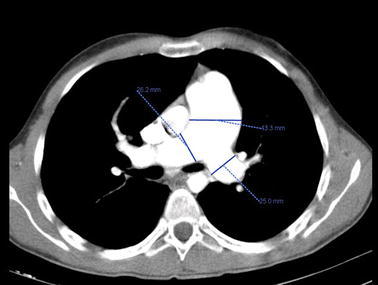 Fig. 2