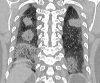 Figure 1a: