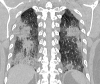 Figure 1c: