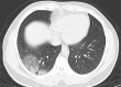 Figure 2b: