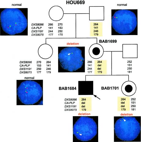 Figure  4