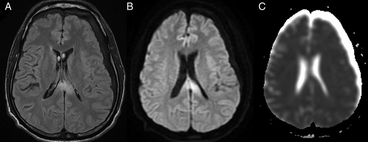 Figure 2