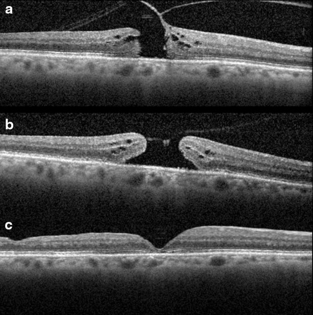 Fig. 3