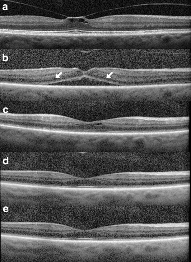 Fig. 2