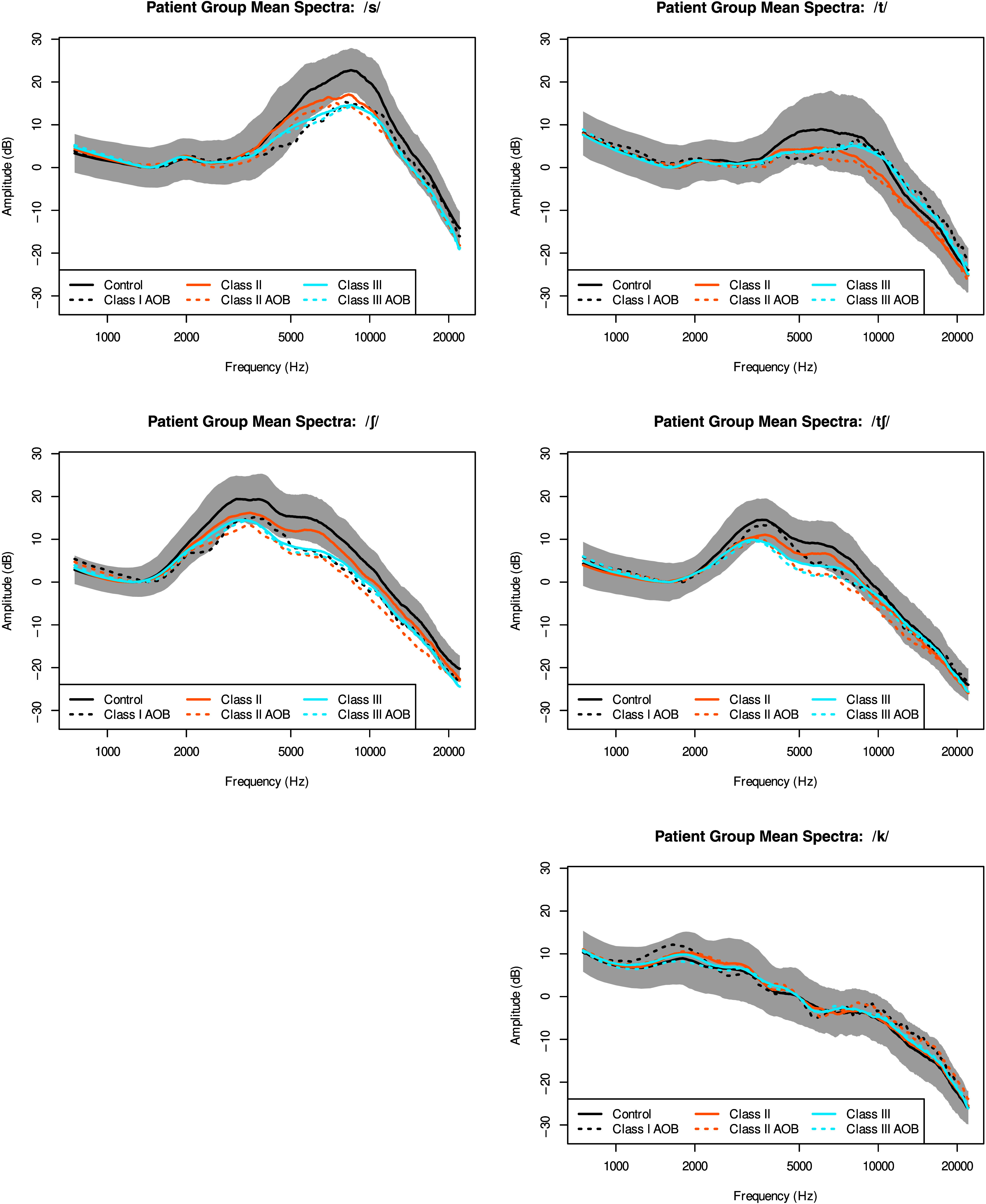 5 graphs. In all the graphs, the y axis represents the amplitude in decibels and it ranges from negative 30 to 30 in increments of 10. The y axis represents the frequency in hertz and it ranges from 1000 to 20,000. In each graph, 6 curves are plotted. The legend for the curves is as follows. Solid black: Control. Dashed black: Class 1 A O B. Solid Orange: Class 2. Dashed orange: Class 2 A O B. Solid blue: Class 3. Dashed blue: Class 3 A O B. Graph 1. Patient group mean spectra for s between forward slashes. The solid black curve passes through (1000, 2), (2000, 3), (10,000, 21), and (20,000, negative 12). All the other curves pass near (1000, 2), (3000, 3), (10,000, 12) and (20,000, negative 20). Graph 2. Patient group mean spectra for t between forward slashes. All the curves pass near (1000, 5), (2000, 0), (7000, 8), and (20,000, negative 30). Graph 3. Patient group mean spectra for elongated s between forward slashes. All the curves pass near (1000, 2), (2000, 6), (3500, 18), and (20000, negative 20). Graph 4. The title of the graph is Patient group mean spectra for t, elongated s between forward slashes. All the curves pass near (1000, 1), (1500, 0), (3500, 15), and (20,000, negative 25). Graph 5. The title of the graph is patient group mean spectra for k between forward slashes. All the curves start near (1000, 8), (5000, 0), and (20,000, negative 25). All values are estimates.