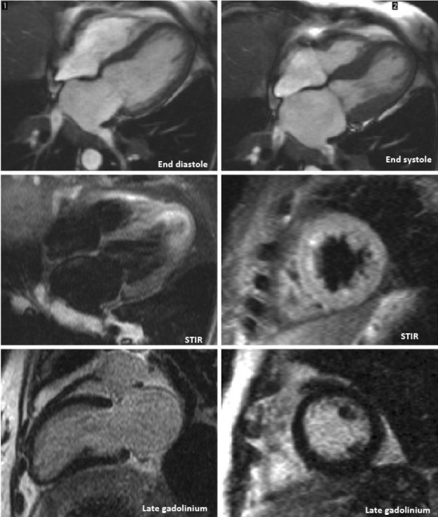 Figure 3