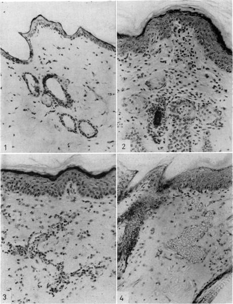 Fig. 1-4