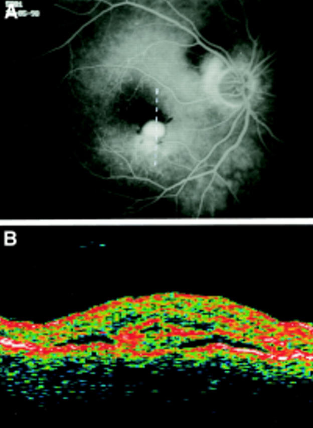 Figure 4  