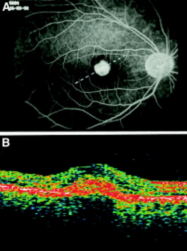 Figure 1  