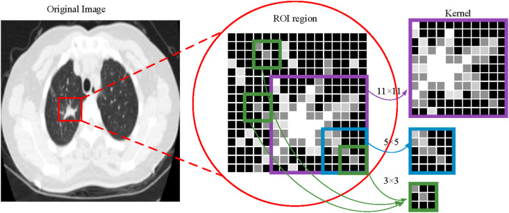 Fig. 11