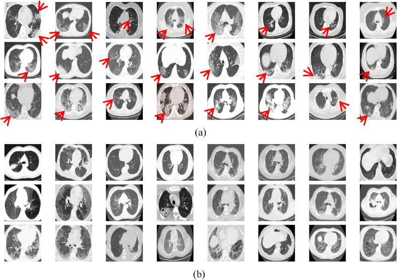 Fig. 13