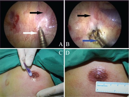 Fig. 2