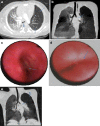 Fig. 4