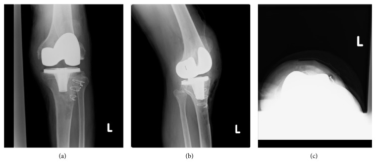 Figure 4