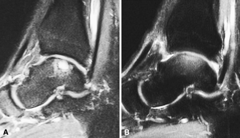 Fig. 7A–B