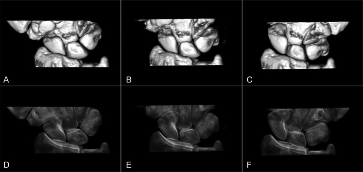 FIG. 4.