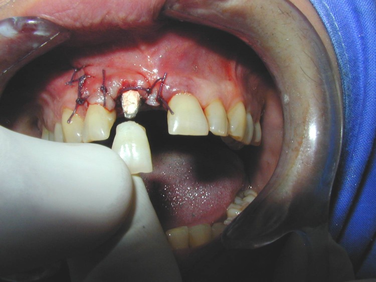 Fig. 6