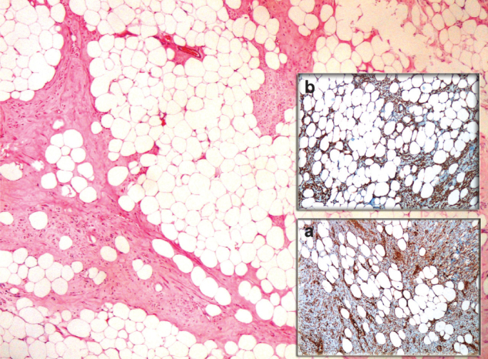 FIG. 2. a, b.