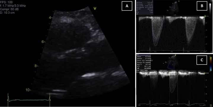 Figure 1