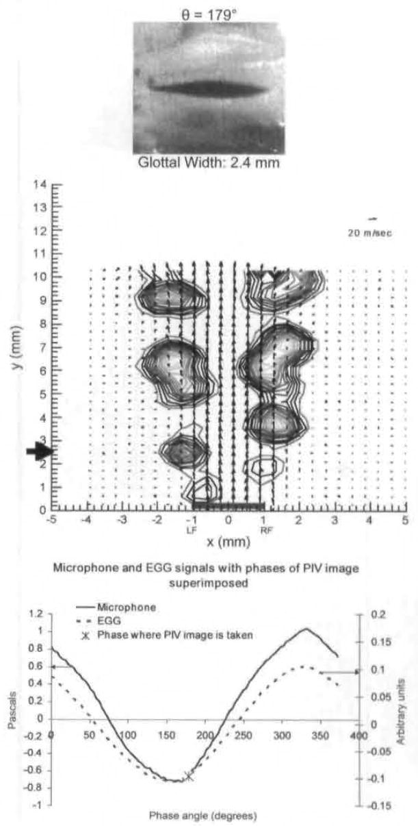 Fig 5