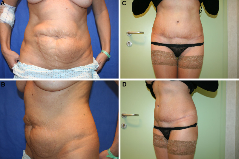Fig. 6.