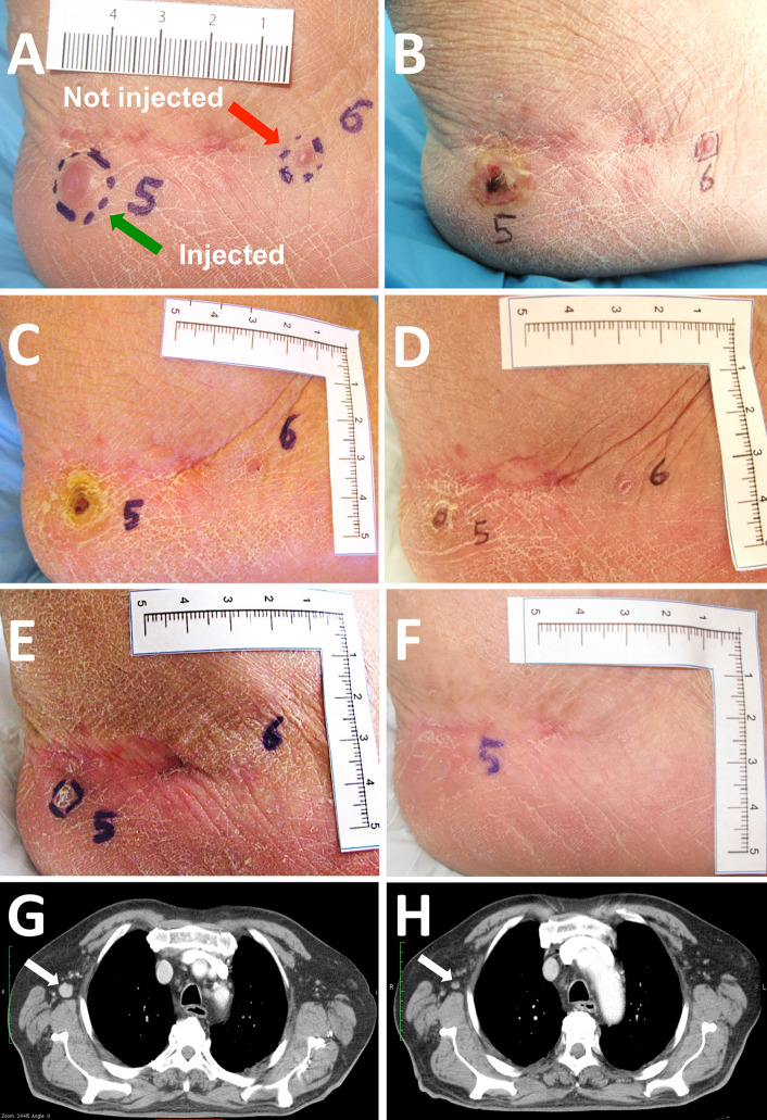 Fig. 2