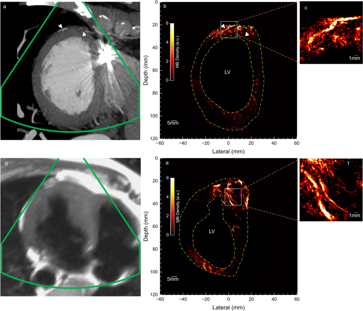 Extended Data Fig. 4