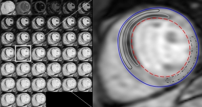 Fig. 1