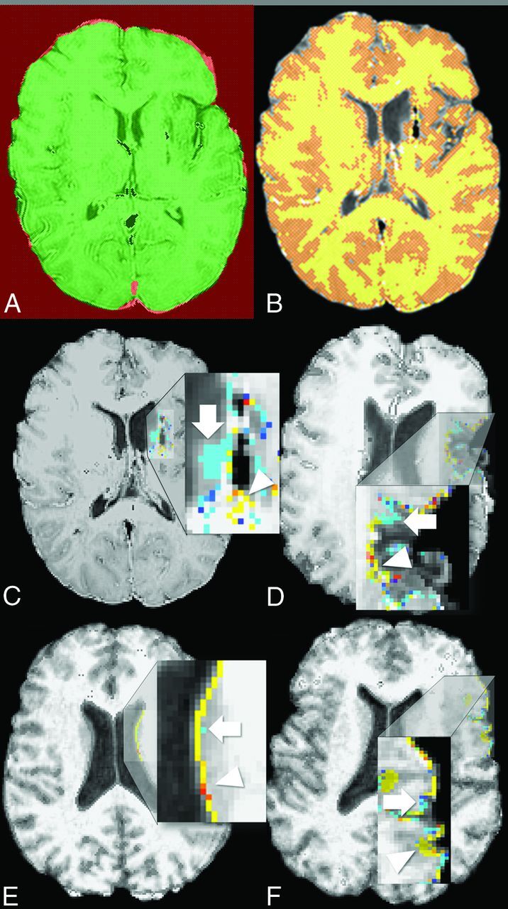 Fig 1.