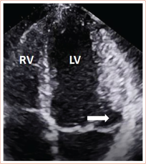 Figure 4: