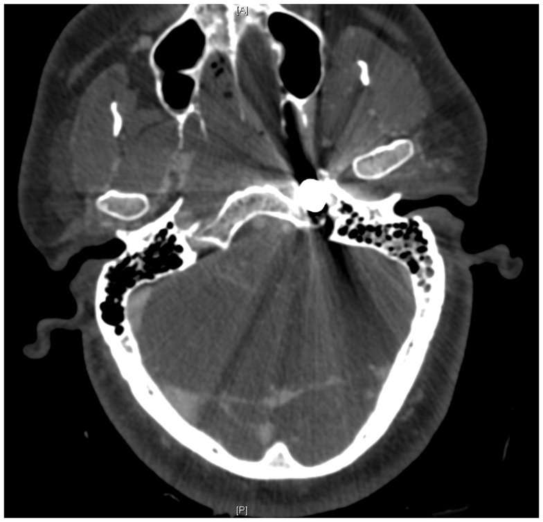 Figure 7