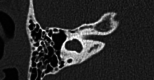 Fig2