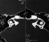 Fig1