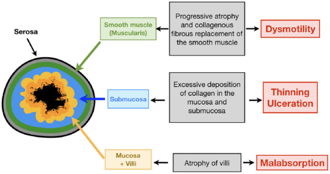 Radiological findings in gastrointestinal scleroderma - PMC