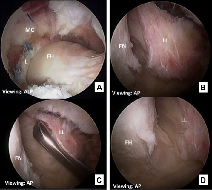 Fig 2