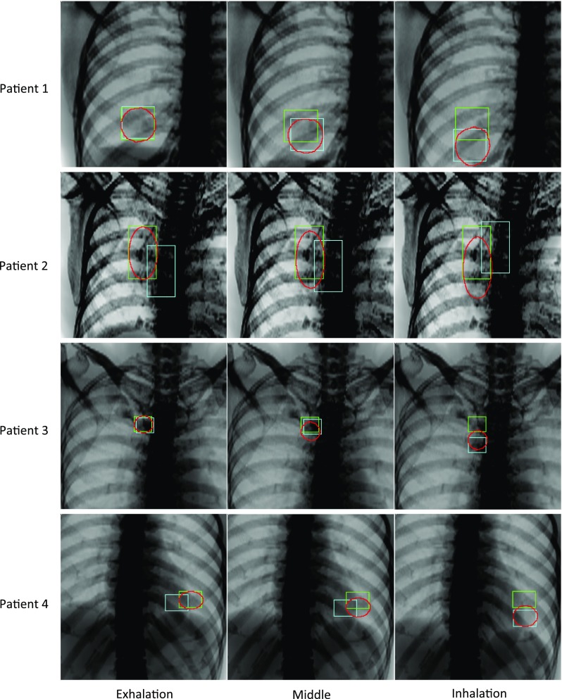 Fig. 7