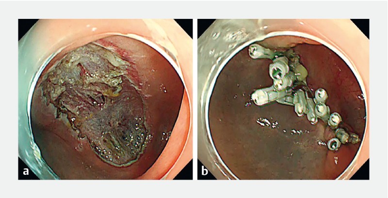 Fig. 1