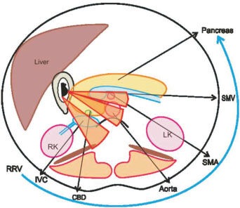 Figure 27