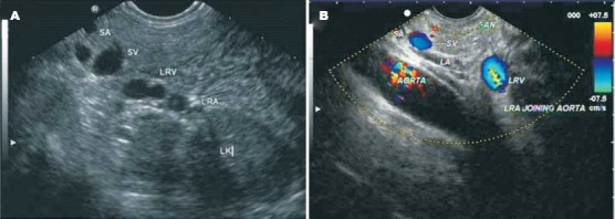 Figure 14