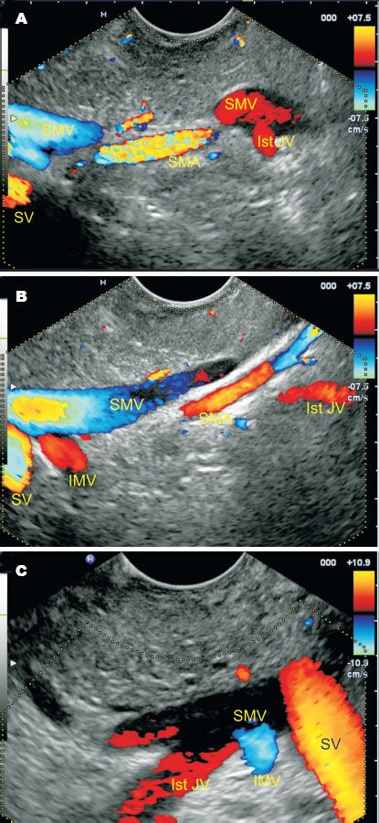 Figure 36