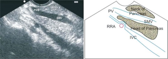 Figure 21