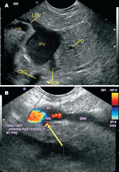 Figure 38