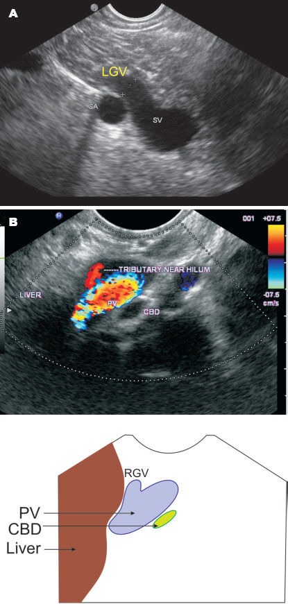 Figure 33