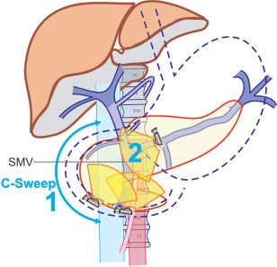 Figure 20