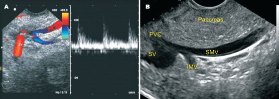 Figure 25