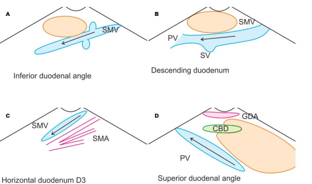 Figure 26