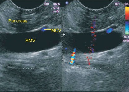 Figure 39